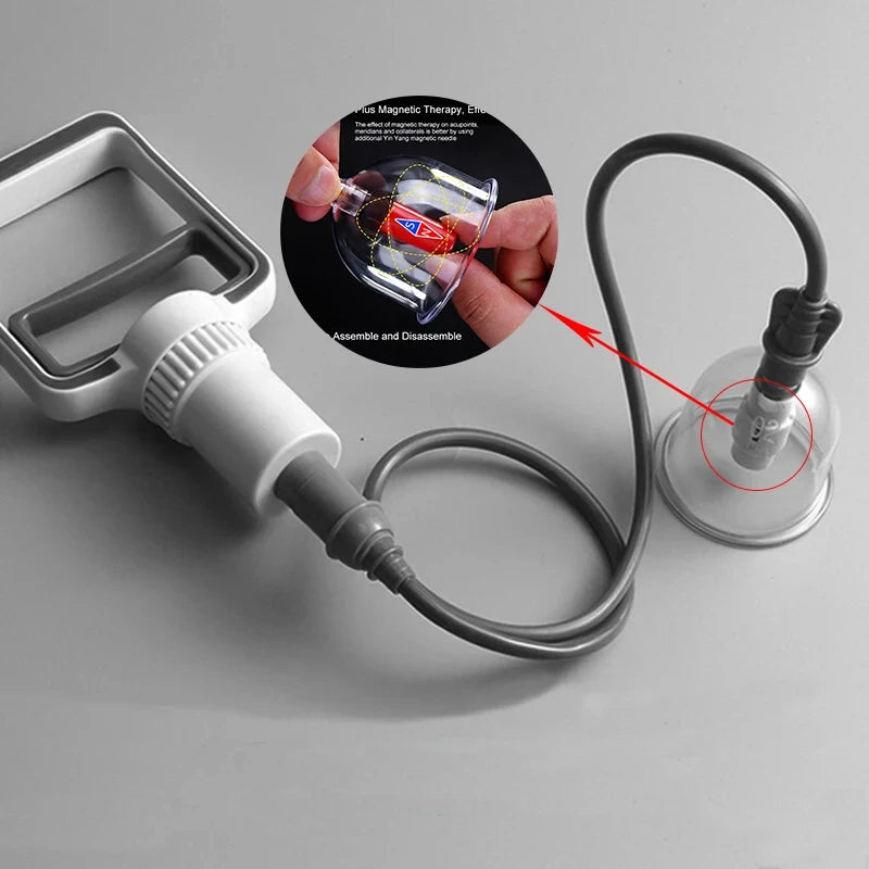 Vacuum Cupping Set
